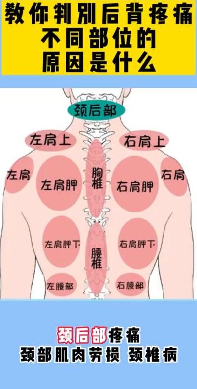 后背酸痛部位图解大全（后背酸疼痛位置图详解）