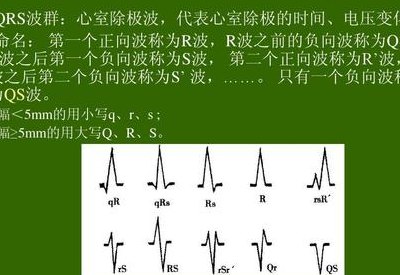 RSQ是什么意思（rsr是什么意思）