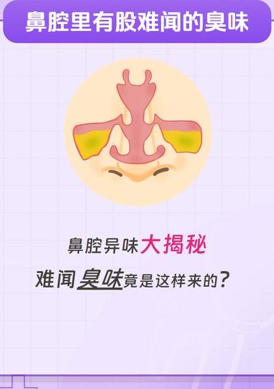 怎么去除房间难闻气味（怎么去除房间难闻气味除臭味）