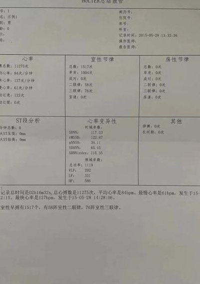 如何看心电图报告单（如何看心电图报告单的电子版）