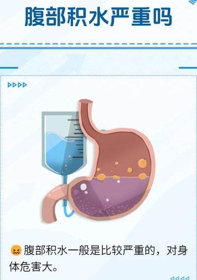腹水严重怎么办（腹水严重怎么办能治好吗）