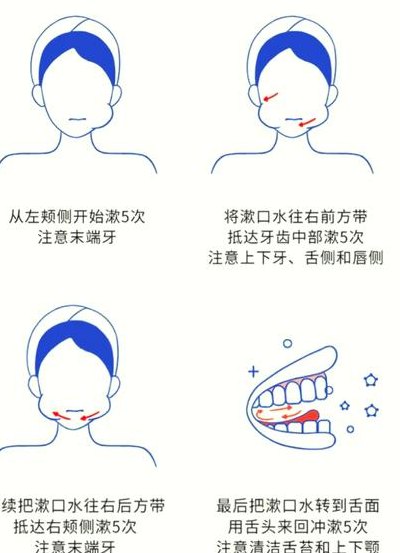 漱口水正确用法方法（漱口水正确用法方法视频）